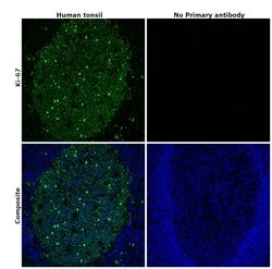 Invitrogen Ki-67 Monoclonal Antibody (SolA15), Alexa Fluor 488, eBioscience