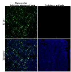 Invitrogen Ki-67 Monoclonal Antibody (SolA15), Alexa Fluor 488, eBioscience