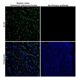 Invitrogen Ki-67 Monoclonal Antibody (SolA15), Alexa Fluor 488, eBioscience