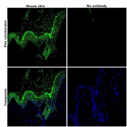 Invitrogen Pan Cytokeratin Monoclonal Antibody (AE1/AE3), Alexa Fluor 488,