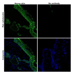 Invitrogen Pan Cytokeratin Monoclonal Antibody (AE1/AE3), Alexa Fluor 488,