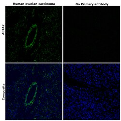 Alpha-Smooth Muscle Actin Monoclonal Antibody (1A4), Alexa Fluor 488, eBioscience