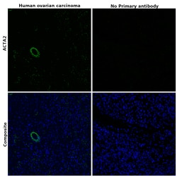Alpha-Smooth Muscle Actin Monoclonal Antibody (1A4), Alexa Fluor 488, eBioscience