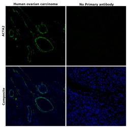 Alpha-Smooth Muscle Actin Monoclonal Antibody (1A4), Alexa Fluor 488, eBioscience