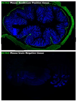 Alpha-Smooth Muscle Actin Monoclonal Antibody (1A4), Alexa Fluor 488, eBioscience