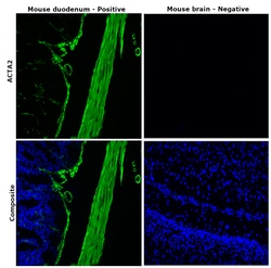 Alpha-Smooth Muscle Actin Monoclonal Antibody (1A4), Alexa Fluor 488, eBioscience