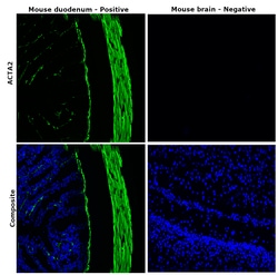 Alpha-Smooth Muscle Actin Monoclonal Antibody (1A4), Alexa Fluor 488, eBioscience