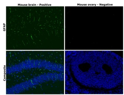 Invitrogen&trade;&nbsp;GFAP Monoclonal Antibody (GA5), Alexa Fluor&trade; 488, eBioscience&trade;, Invitrogen&trade;