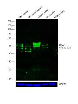 Invitrogen&trade;&nbsp;GFAP Monoclonal Antibody (GA5), Alexa Fluor&trade; 488, eBioscience&trade;, Invitrogen&trade;
