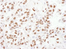 53BP1 Goat anti-Human, Polyclonal, Bethyl Laboratories 100 &mu;L; Unconjugated:Antibodies,