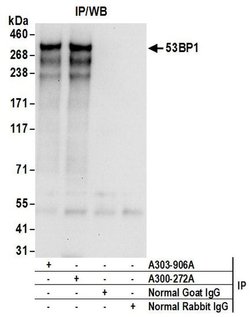 53BP1 Goat anti-Human, Polyclonal, Bethyl Laboratories 100 &mu;L; Unconjugated:Antibodies,