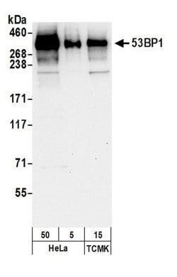 53BP1 Polyclonal Antibody, Bethyl Laboratories 20 &mu;l; Unlabeled:Antibodies,