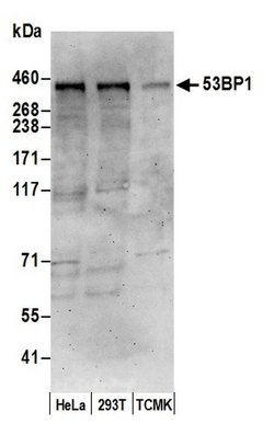 53BP1 Rabbit anti-Human, Mouse, Polyclonal, Bethyl Laboratories 100 &mu;L;