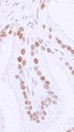 53BP1 Polyclonal Antibody, Bethyl Laboratories 10 &mu;L; Unconjugated:Antibodies,