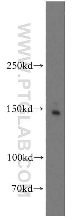 Drosha Rabbit anti-Human, Mouse, Rat, Polyclonal, Proteintech 150 &mu;L | Buy Online | Proteintech Group Inc | Fisher Scientific