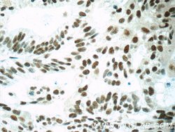SETD1B Rabbit anti-Human, Mouse, Polyclonal, Proteintech:Antibodies:Primary