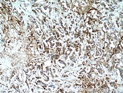 WDFY3 Rabbit anti-Human, Mouse, Polyclonal, Proteintech:Antibodies:Primary