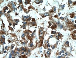 WDFY3 Rabbit anti-Human, Mouse, Polyclonal, Proteintech:Antibodies:Primary