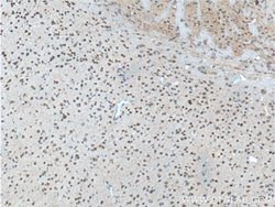 WDFY3 Rabbit anti-Human, Mouse, Polyclonal, Proteintech:Antibodies:Primary