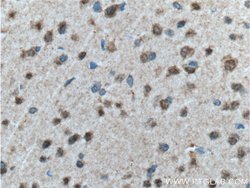 WDFY3 Rabbit anti-Human, Mouse, Polyclonal, Proteintech:Antibodies:Primary
