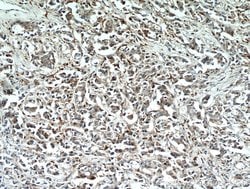 WDFY3 Rabbit anti-Human, Mouse, Polyclonal, Proteintech