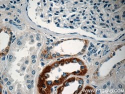 MAF Rabbit anti-Human, Mouse, Rat, Polyclonal, Proteintech:Antibodies:Primary