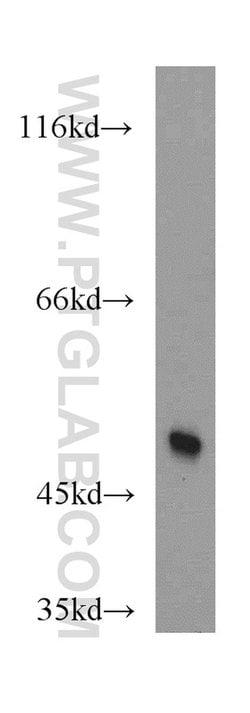 MAF Rabbit anti-Human, Mouse, Rat, Polyclonal, Proteintech:Antibodies:Primary