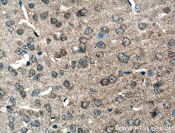 p75NTR Rabbit anti-Human, Mouse, Rat, Polyclonal, Proteintech:Antibodies:Primary