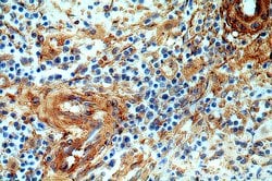 p75NTR Rabbit anti-Human, Mouse, Rat, Polyclonal, Proteintech:Antibodies:Primary