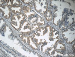 p75NTR Rabbit anti-Human, Mouse, Rat, Polyclonal, Proteintech:Antibodies:Primary