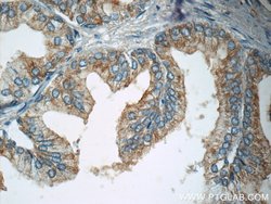 p75NTR Rabbit anti-Human, Mouse, Rat, Polyclonal, Proteintech:Antibodies:Primary