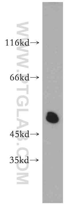Synaptotagmin-12 Rabbit anti-Human, Mouse, Rat, Polyclonal, Proteintech 150 &mu;L | Buy Online | Proteintech Group Inc | Fisher Scientific