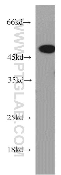 Synaptotagmin-12 Rabbit anti-Human, Mouse, Rat, Polyclonal, Proteintech 150 &mu;L | Buy Online | Proteintech Group Inc | Fisher Scientific