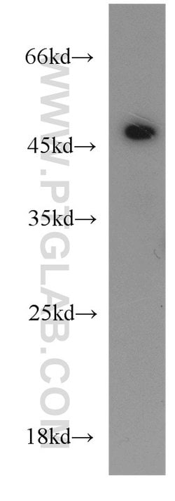 Synaptotagmin-12 Rabbit anti-Human, Mouse, Rat, Polyclonal, Proteintech 150 &mu;L | Buy Online | Proteintech Group Inc | Fisher Scientific