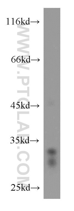 Cathepsin D Rabbit anti-Human, Mouse, Polyclonal, Proteintech