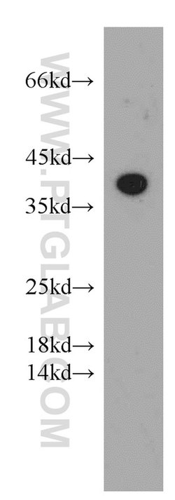 Adenosine A1 Receptor Rabbit anti-Human, Mouse, Polyclonal, Proteintech:Anticuerpos:Anticuerpos