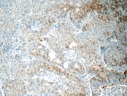 CSPG4/NG2 Rabbit anti-Human, Mouse, Rat, Polyclonal, Proteintech 150 &mu;L;