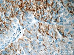 CSPG4/NG2 Rabbit anti-Human, Mouse, Rat, Polyclonal, Proteintech 150 &mu;L;