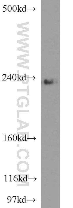 CSPG4/NG2 Rabbit anti-Human, Mouse, Rat, Polyclonal, Proteintech 150 &mu;L;
