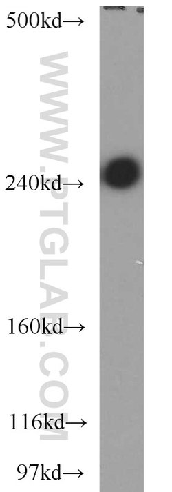 CSPG4/NG2 Rabbit anti-Human, Mouse, Rat, Polyclonal, Proteintech 150 &mu;L;