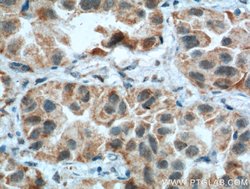 CSPG4/NG2 Rabbit anti-Human, Mouse, Rat, Polyclonal, Proteintech 150 &mu;L;