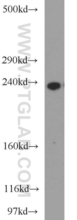CSPG4/NG2 Rabbit anti-Human, Mouse, Rat, Polyclonal, Proteintech 150 &mu;L;