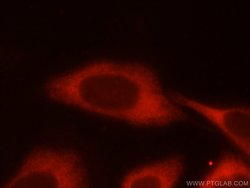 PFKM Rabbit anti-Human, Mouse, Rat, Polyclonal, Proteintech 150 &mu;L;
