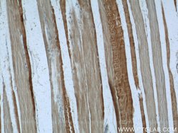 PFKM Rabbit anti-Human, Mouse, Rat, Polyclonal, Proteintech 150 &mu;L;