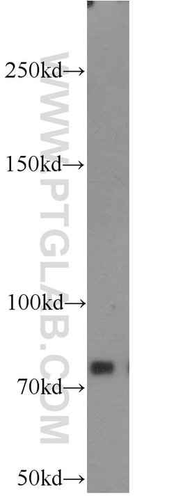 PFKM Rabbit anti-Human, Mouse, Rat, Polyclonal, Proteintech 150 &mu;L;