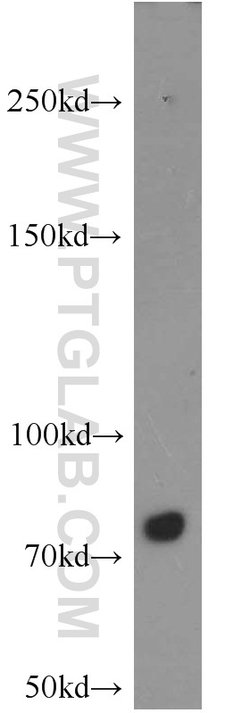 PFKM Rabbit anti-Human, Mouse, Rat, Polyclonal, Proteintech 150 &mu;L;