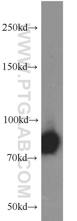 PFKM Rabbit anti-Human, Mouse, Rat, Polyclonal, Proteintech 150 &mu;L;