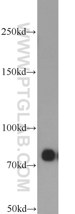 PFKM Rabbit anti-Human, Mouse, Rat, Polyclonal, Proteintech 150 &mu;L;