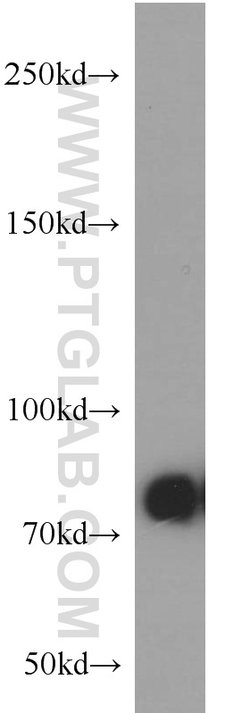 PFKM Rabbit anti-Human, Mouse, Rat, Polyclonal, Proteintech 150 &mu;L;