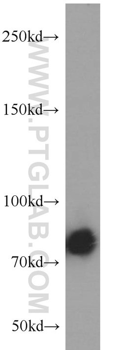 PFKM Rabbit anti-Human, Mouse, Rat, Polyclonal, Proteintech 150 &mu;L;